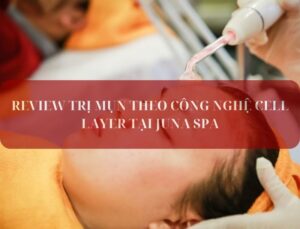 REVIEW TRỊ MỤN THEO CÔNG NGHỆ CELL LAYER TẠI JUNA SPA