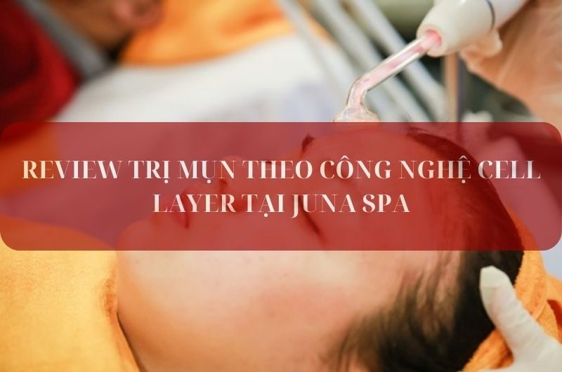 REVIEW TRỊ MỤN THEO CÔNG NGHỆ CELL LAYER TẠI JUNA SPA