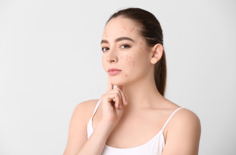 Tẩy tế bào chết đều đặn