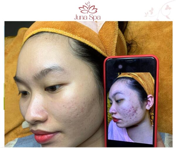 Top Spa Việt Nam