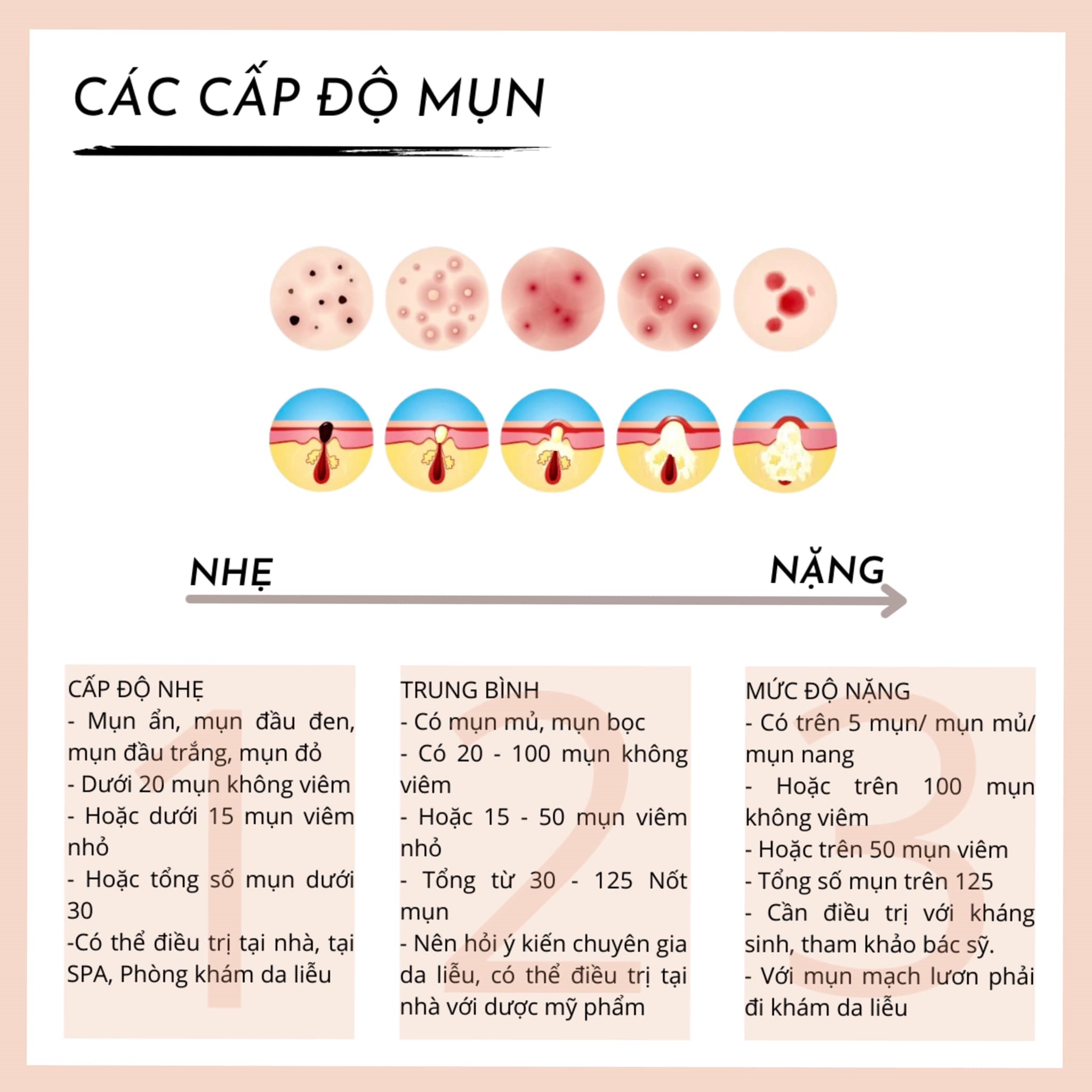 3. Các Cấp Độ Mụn