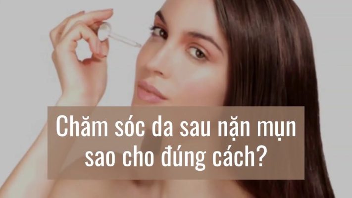 Những thói quen cần tránh sau khi nặn mụn