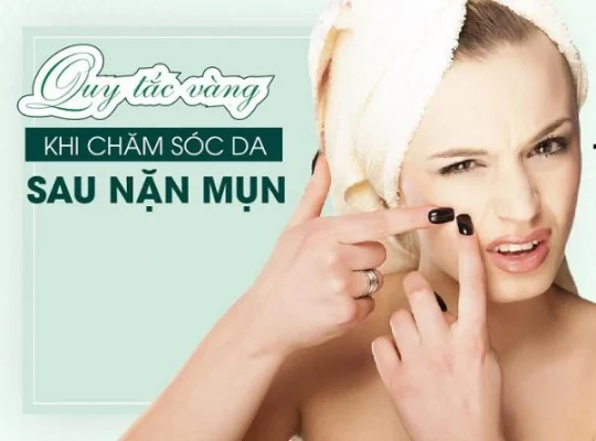Sau khi nặn mụn có nên rửa mặt không