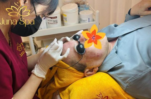 lấy nhân mụn juna spa